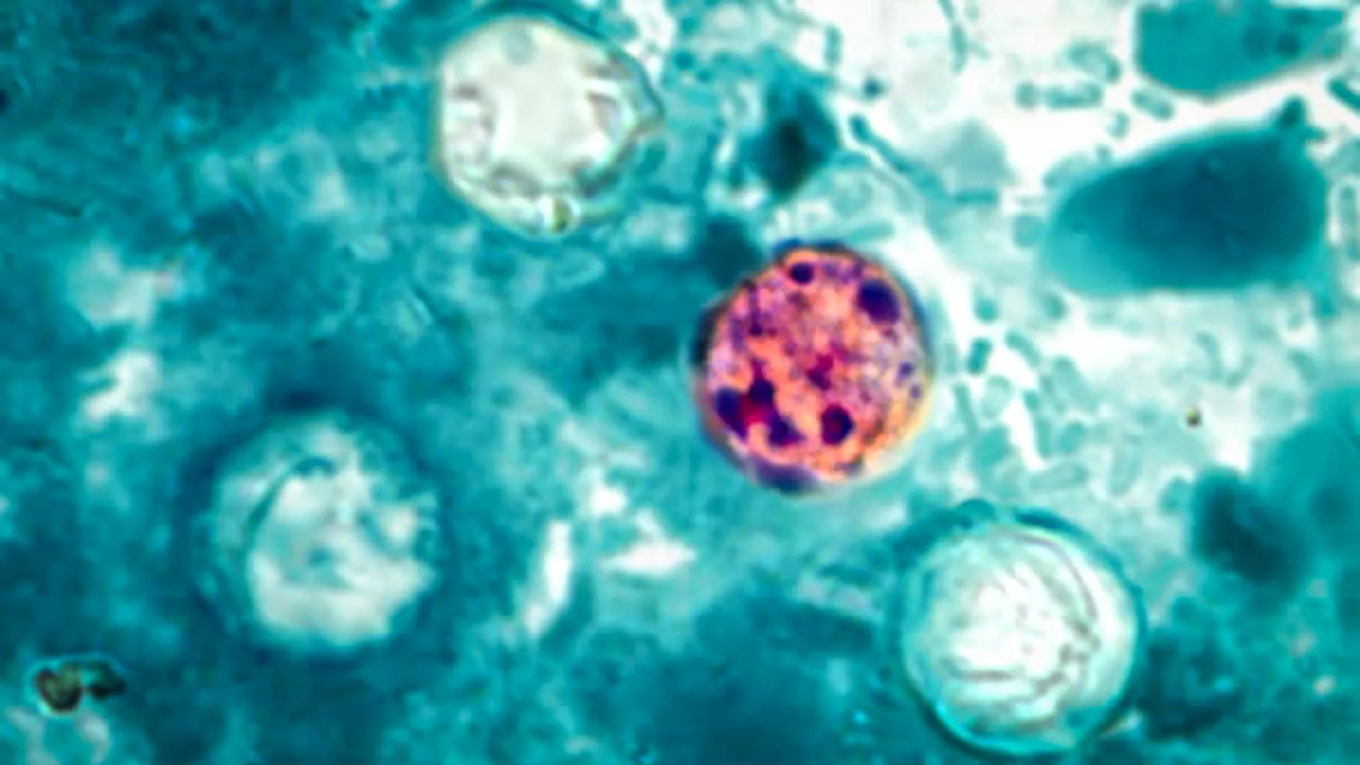 More than 400 sick as CDC searches for the source of a mystery outbreak