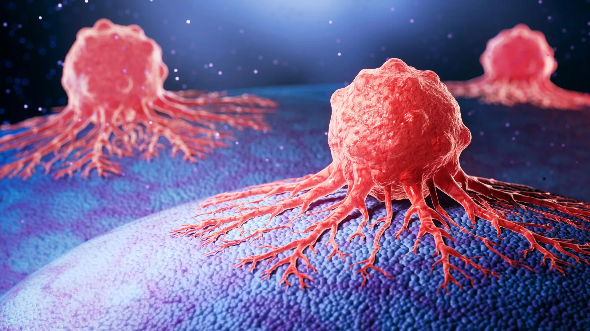 New antibody drug stops aggressive prostate cancer from spreading New antibody drug stops aggressive prostate cancer from spreading